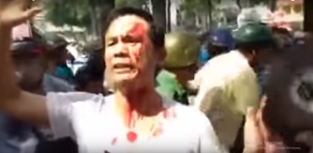 Anh Trần Bang (Sài Gòn) bị đánh khi anh tham gia biểu tình ngày 5-11-2015 phản đối trùm xâm lược Tập Cận Bình sang Việt 